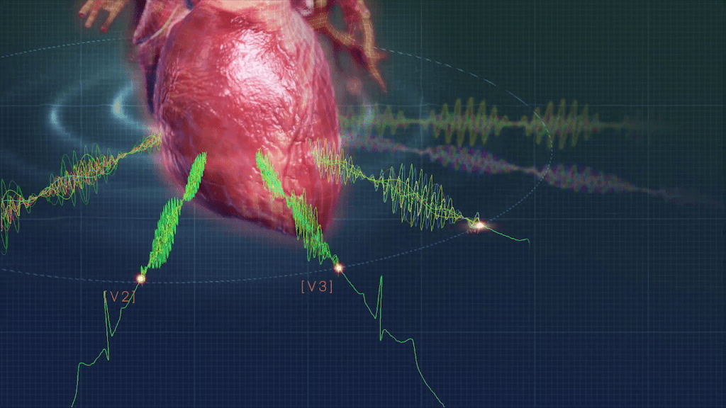 An illustration of a human heart is overlaid with green waveforms and electronic signals, resembling ECG analysis. Hidden signals dance across a background featuring a blue gradient grid pattern, bringing the scene to life with subtle animation effects.