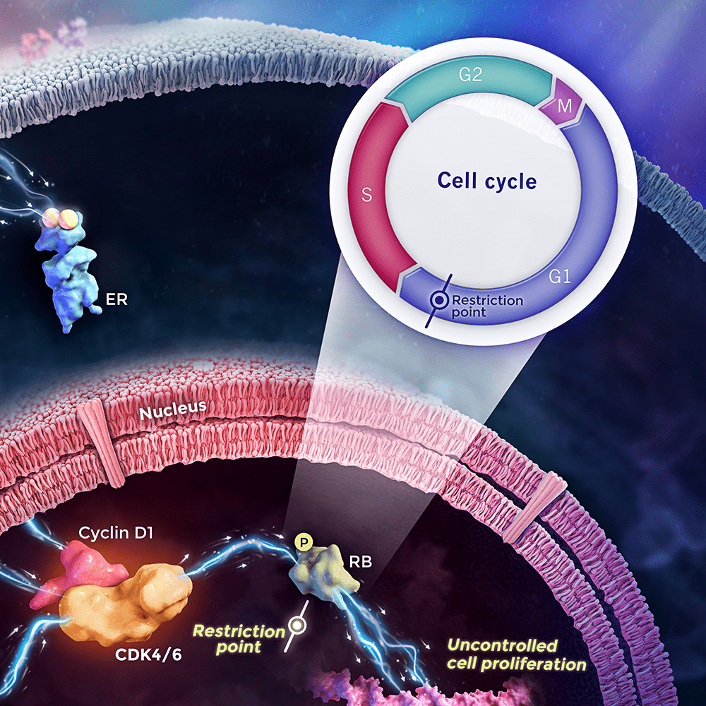 Breast Cancer Pathway Illustration