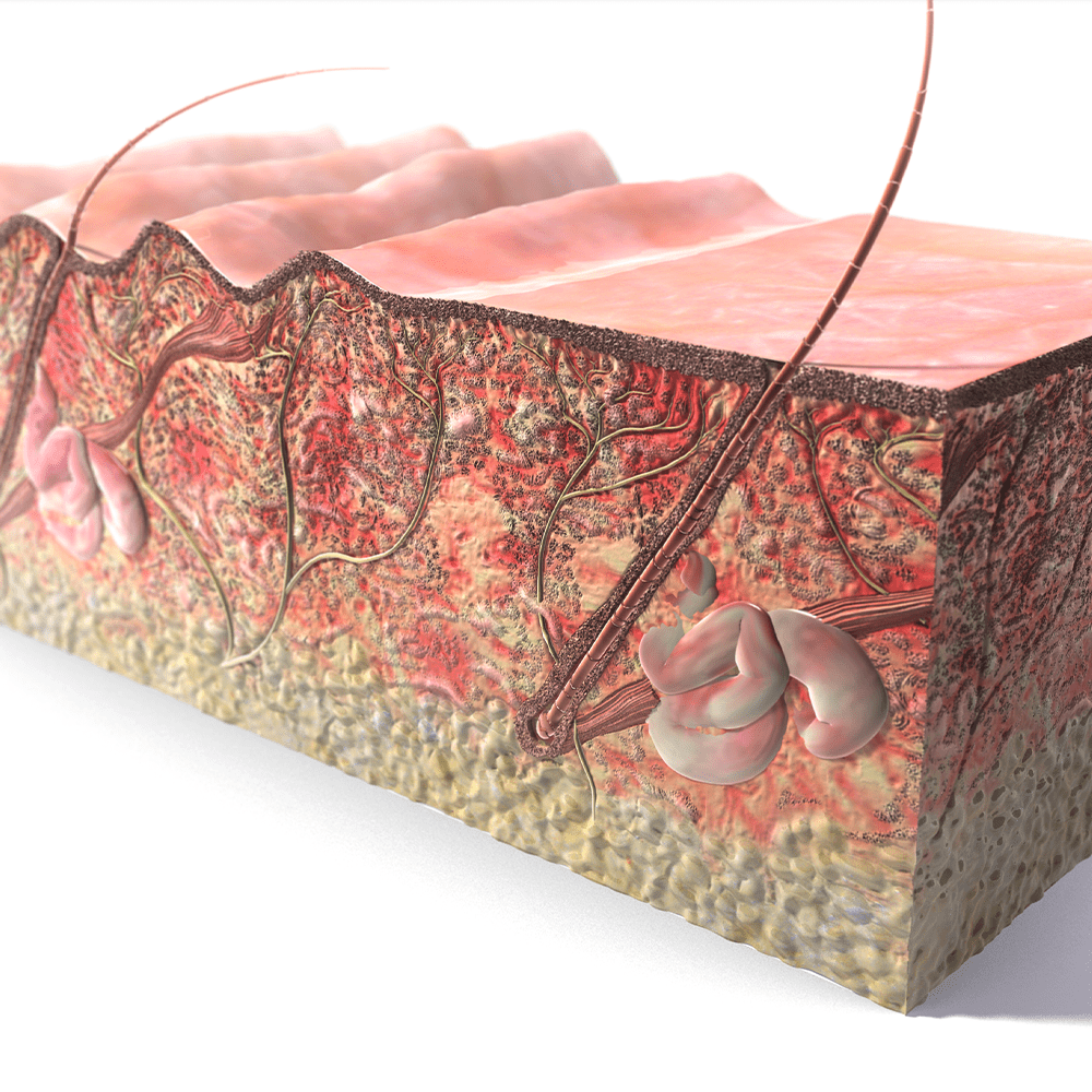 Cross Section of Wrinkled Skin