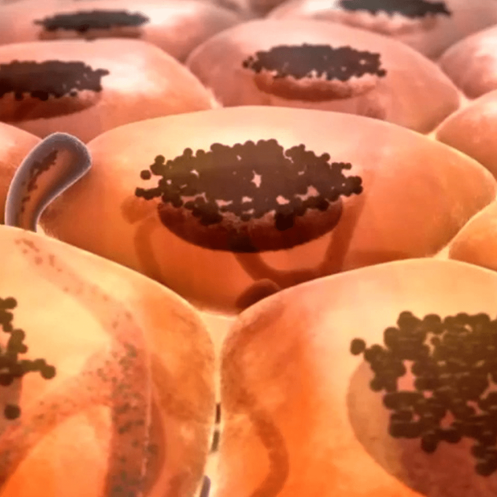 FROM MELANOCYTE TO MELANOMA