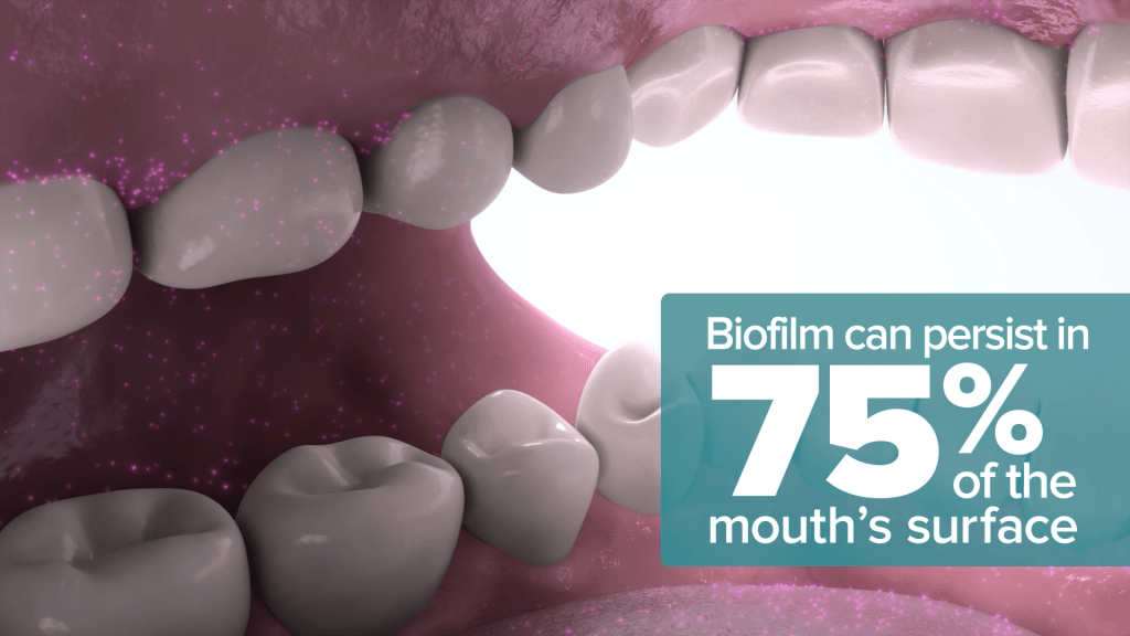 An illustration of teeth with visible biofilm highlights oral hygiene. A corner text box reads: Biofilm can persist in 75% of the mouths surface. The image shows upper and lower teeth, promoting Listerine mouthwash for a cleaner, healthier smile.