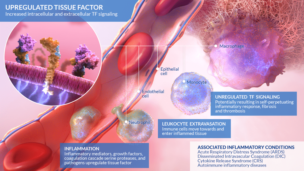 This medical illustration depicts upregulated tissue factor signaling within a blood vessel, emphasizing endothelial cells, monocytes, macrophages, neutrophils, and epithelial cells. It highlights inflammation and conditions such as ARDS and thrombosis with precision.