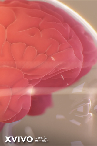 Illustration of a human brain in shades of pink and red, showcasing the brains folds and crevices. The image includes a faint, branded watermark XVIVO scientific animation in the corner.