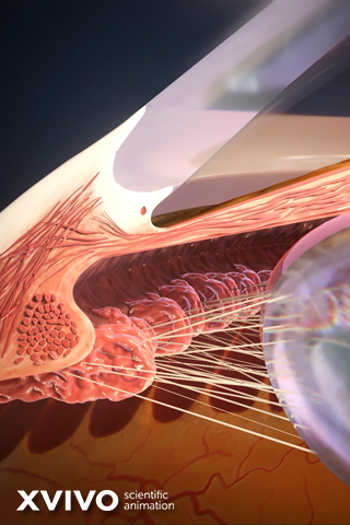 A detailed scientific illustration of an eyes internal structure, showing parts like the optic nerve, muscles, and connective tissues. The image highlights the complexity of eye anatomy with precise anatomical features.