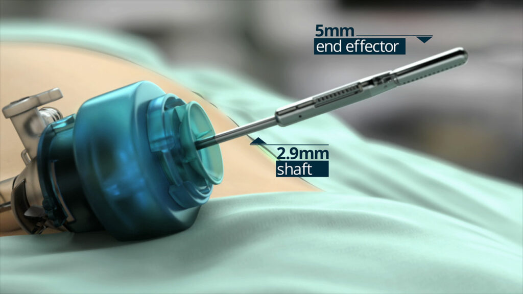 Close-up of a surgical trocar, captured as if from a XVIVO medical animation, in a sterile environment. The image highlights the instruments dimensions, labeling the end effector as 5mm and the shaft as 2.9mm. Blurred surgical drapes create an authentic backdrop for this precise medical visualization.