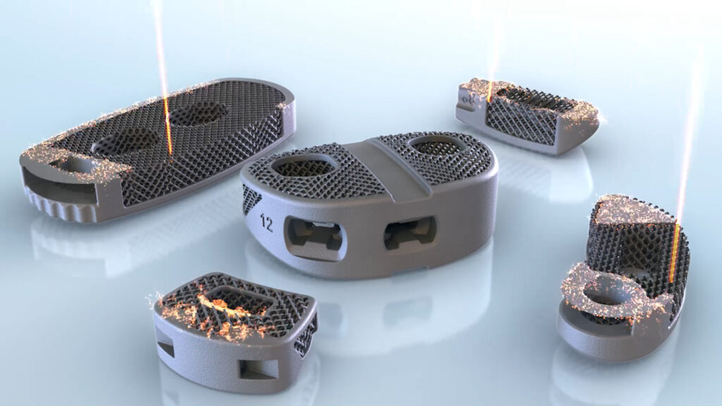A collection of metallic spine implant components on a reflective surface, enhanced with XVIVOs precision. Laser beams etch their textured surfaces, creating sparks. The implants vary in shape and are arranged in a semicircle formation like mesmerizing medical device animations.