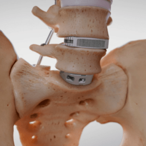 Medical Device Animation