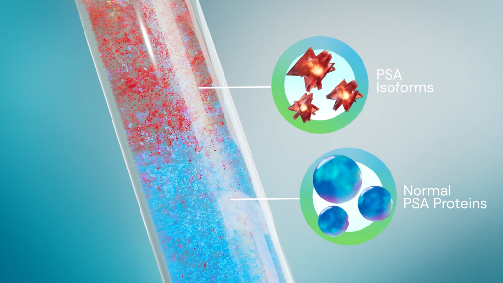 test tube with normal PSA and PSA isoforms