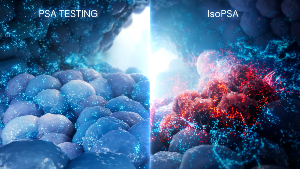 cell environment comparing traditional PSA testing with IsoPSA testing