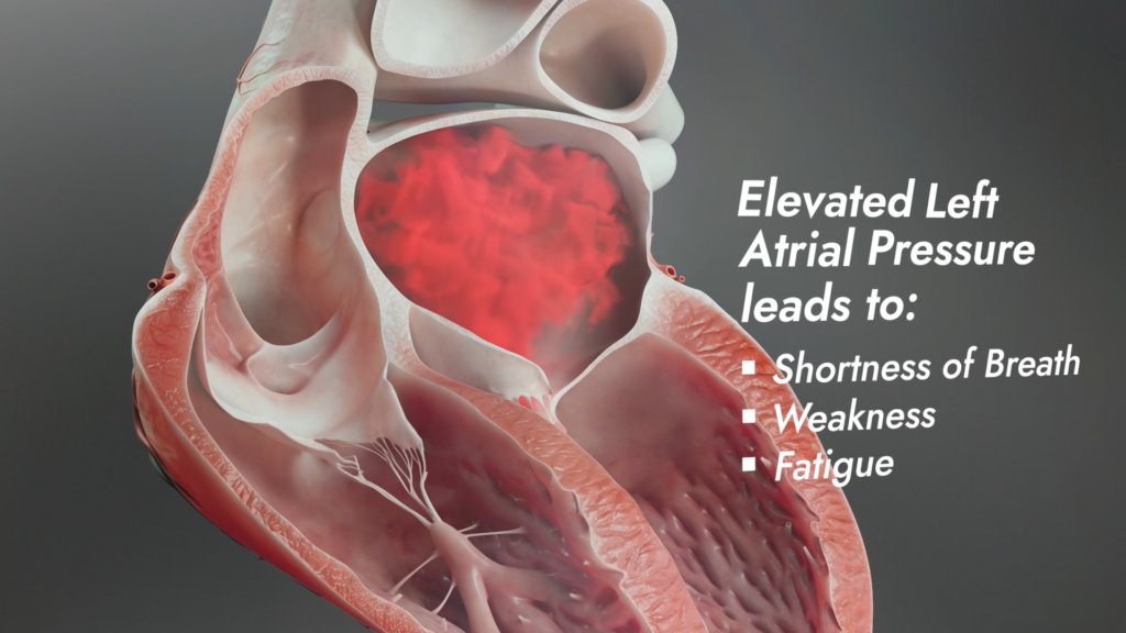 cross section of heart